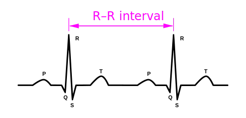 RR Interval